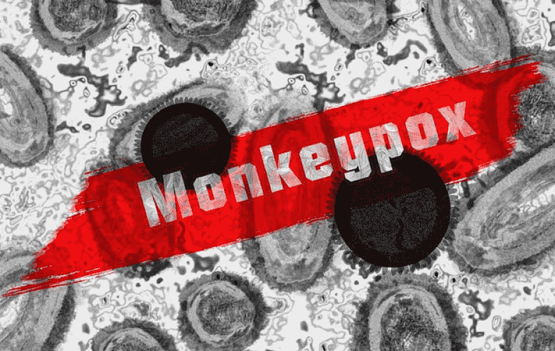 317 confirmed monkeypox cases in Berlin