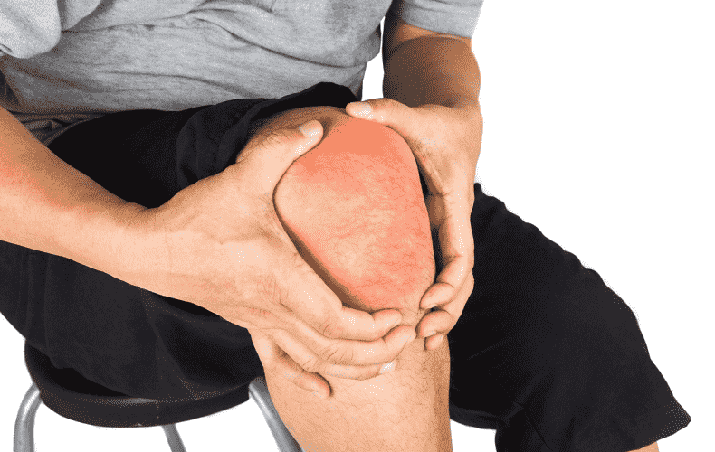 Unraveling the Complexities of Knee Pain