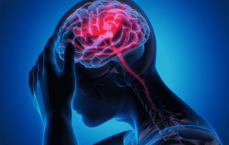 Migraine: Unraveling the Mysteries Behind a Debilitating Condition
